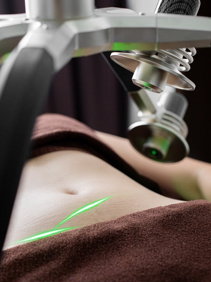 Crop unrecognizable female client covered with towels lying under laser weight loss machine with heads during procedure in light modern clinic